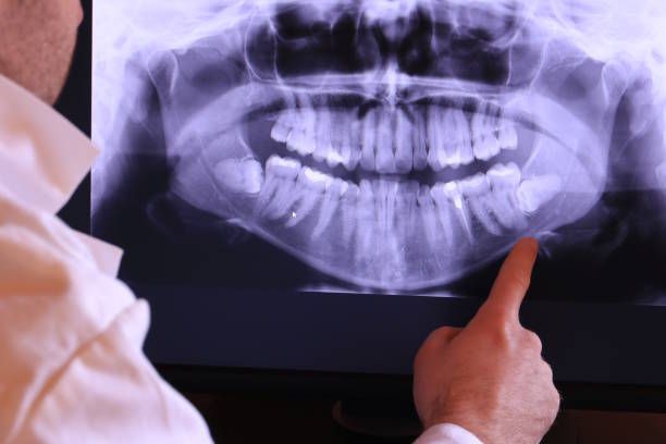 Best Emergency Tooth Extraction in Arden Hills, MN
