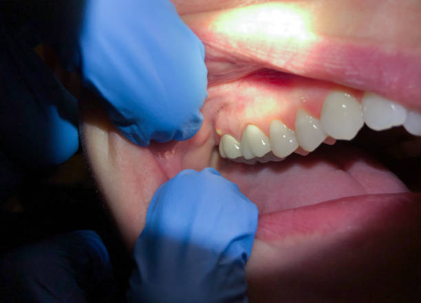 Best Emergency Orthodontic Repairs in Arden Hills, MN
