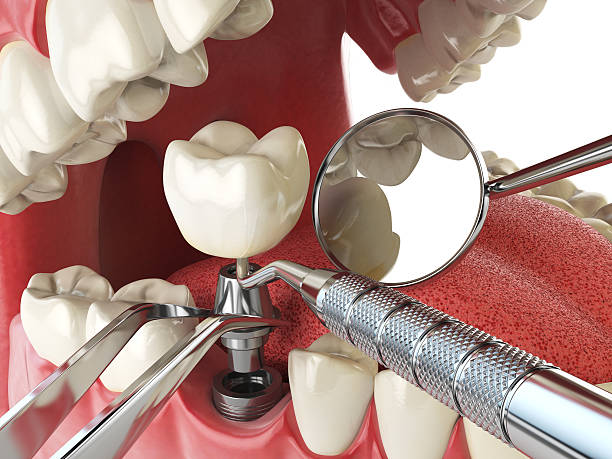 Best Weekend Emergency Dentist in Arden Hills, MN